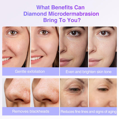 Diamond Dermabrasion Head, 6 PCS Dermabrasion Replacement Tips, Professional Microdermabrasion Accessories for Microdermabrasion Machine